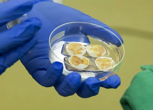 This photo provided by Duke Health shows thymus tissue for transplant to a pediatric heart patient on Aug. 16, 2021 at Duke University Hospital in Durham, N.C. Duke University doctors say the baby is thriving after a first-of-its-kind heart transplant -- one that came with a bonus technique to try to help prevent rejection of the new organ. The thymus plays a critical role in building the immune system. (Shawn Rocco/Duke Health via AP)