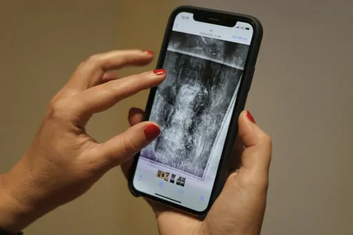 Inna Berkowits, an art historian at the Haifa University's Hecht Museum, holds her mobile phone with an image of an x-ray of Amedeo Modigliani's painting "Nude with a Hat" in Haifa, Israel, June 28, 2022. Curators at the museum using x-ray technology have discovered three previously unknown sketches by the celebrated 20th century artist hiding beneath the surface of the painting. (AP Photo/Ariel Schalit)